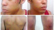 Imagem Agredido em Salvador, jovem acredita ter sido vítima de homofobia