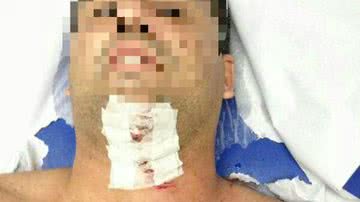 Imagem Policial recebe facada de segurança de bloco
