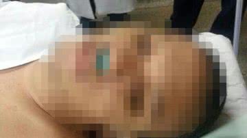 Imagem Durante assalto, policial reage e é baleado por bandidos