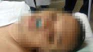Imagem Durante assalto, policial reage e é baleado por bandidos