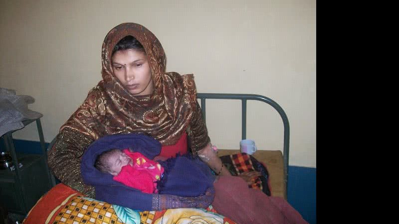 Imagem Bebê nasce com coração do lado de fora do corpo e sobrevive
