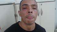 Imagem Homem é preso acusado por tráfico de drogas