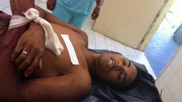 Imagem Camaçari: homem troca tiros com a polícia e acaba baleado