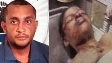 Imagem Homem estupra, espanca e golpeia vagina de mulher com facão