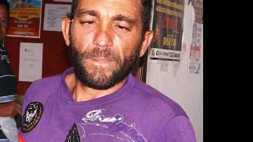 Imagem Caldas do Jorro: mulher interrompe sexo e tem corpo queimado por parceiro