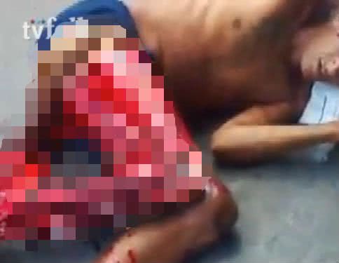 Imagem Imagens fortes: preso tem perna dissecada e morre em presídio do Maranhão