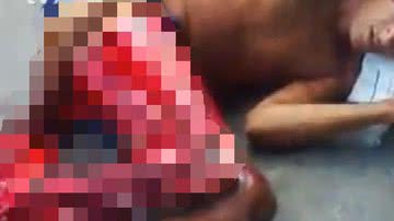 Imagem Imagens fortes: preso tem perna dissecada e morre em presídio do Maranhão