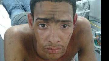 Imagem Assaltante é linchado após tentativa frustrada de roubo de uma motocicleta