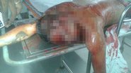 Imagem Homem acusado de tráfico e homicídio é encontrado morto no Curuzu