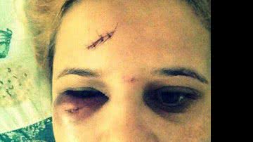 Imagem Chamada de 'macho', skatista sofre agressão de árbitro em praça de SP