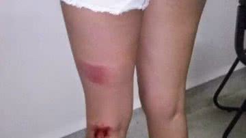 Imagem Vereador teria agredido namorada de filha mais velha em Firmino Alves