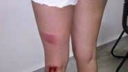 Imagem Vereador teria agredido namorada de filha mais velha em Firmino Alves