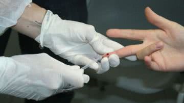 Imagem Até o final do ano 111 postos realizarão testes rápidos para HIV/AIDS