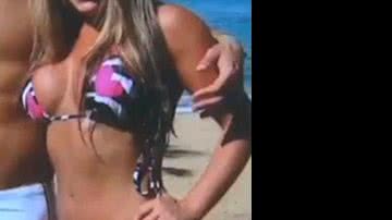 Imagem Jovem vai parar na CTI após falsa médica aplicar acrílico no bumbum