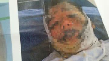 Imagem Entre a vida e a morte no Martagão Gesteira, menino de 13 anos precisa de ajuda