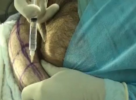 Imagem Cenas fortes: médico faz autocirurgia e publica imagens na internet