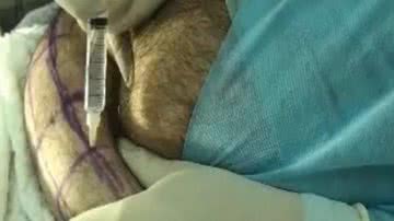 Imagem Cenas fortes: médico faz autocirurgia e publica imagens na internet