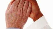 Imagem Cientistas ingleses avançam na cura do Alzheimer e Parkinson