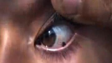 Imagem Vídeo impressionante: garota chora pedras e deixa médicos perplexos