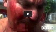 Imagem Imagens fortes: vaza vídeo do homem que cortou os próprios testículos