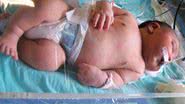 Imagem Bebê gigante nasce com quase 7 kg