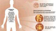 Imagem Salvador registra 108 casos de leptospirose em 2011