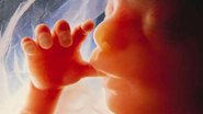 Imagem Justiça autoriza grávida a abortar feto com anencefalia