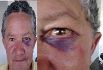 Imagem Presidente do PSDB baiano é acusado de agressão