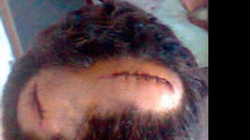 Imagem Casal homossexual é agredido na Estação Pirajá