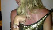 Imagem Susana Werner exagera no sol e fica um pimentão