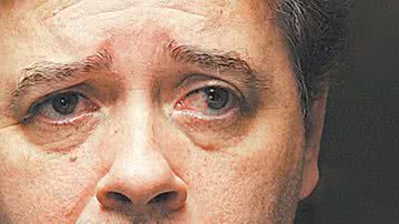 Imagem Dj Malboro descobre tumor na mão