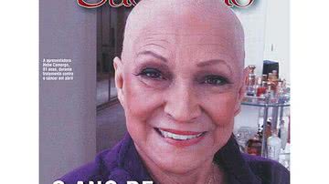 Imagem Careca e feliz!