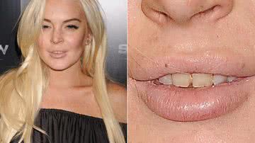 Imagem Lindsay Lohan aparece com os dentes 'podrinhos'