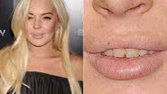 Imagem Lindsay Lohan aparece com os dentes 'podrinhos'