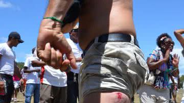 Imagem Greve da PM: Manifestante é baleado no rosto