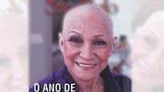Imagem Hebe Camargo passa por cirurgia de emergência 