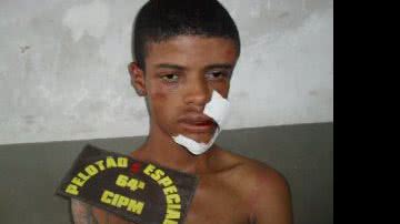 Imagem  Depois de assaltar, jovem é espancado por populares