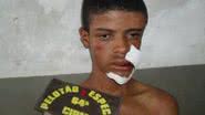 Imagem  Depois de assaltar, jovem é espancado por populares