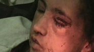 Imagem Adolescente afegã foi torturada por marido, sogro e cunhados