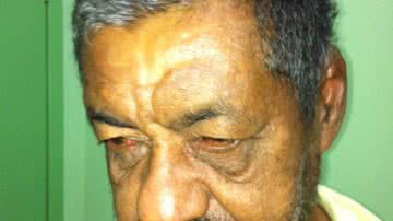 Imagem Traído, marido joga água quente na mulher