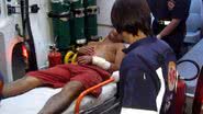 Imagem Homem baleado pede socorro em presídio
