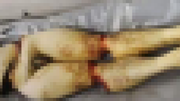 Imagem Vazam fotos de partes do corpo de Kitano Matsunaga. Confira