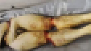 Imagem Vazam fotos de partes do corpo de Kitano Matsunaga. Confira