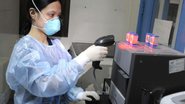 Imagem Novo exame detecta tuberculose em até duas horas