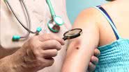 Imagem Câncer: Nova droga contra melanomas duplica sobrevida