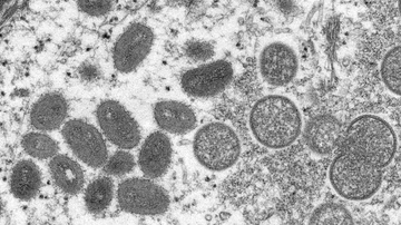Imagem microscópica do vírus da varíola dos macacos - Cynthia S. Goldsmith/CDC