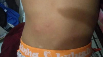 Reprodução/Redes sociais