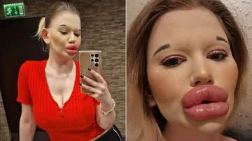 Reprodução | Redes Sociais