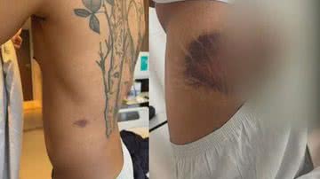 Reprodução/Redes Sociais