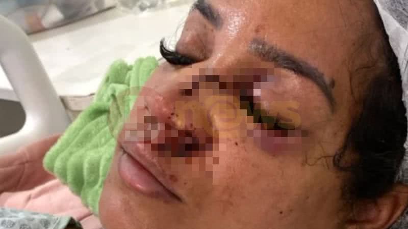 https://www.bnews.com.br/media/_versions/maio_2025/agressaofeira_widelg.jpg